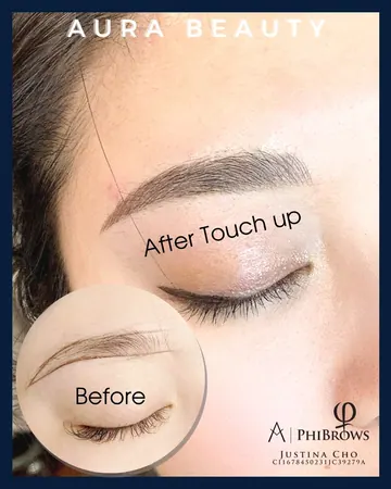 Brow touch-up close-up: healed result alongside the before reference.